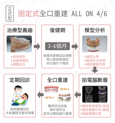 All on 4/6固定式重建