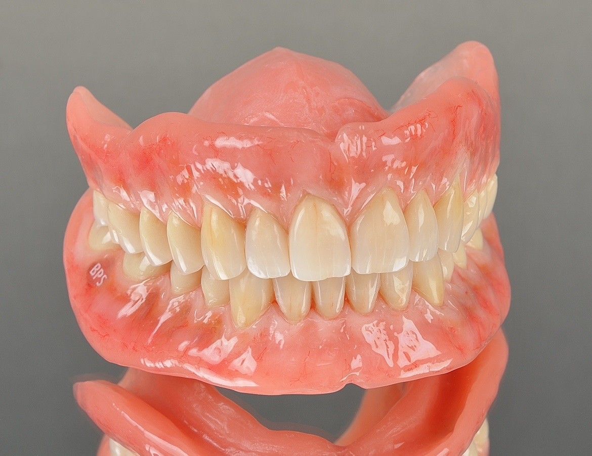 2025更新「吸附式活動假牙」介紹：全面了解吸附式假牙與BPS假牙