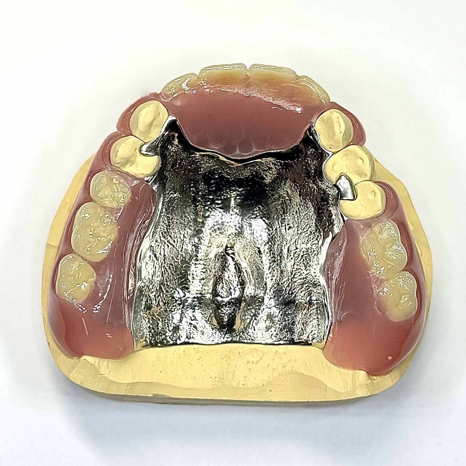 局部活動假牙 MDJ